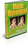 Mole Removal (PLR)